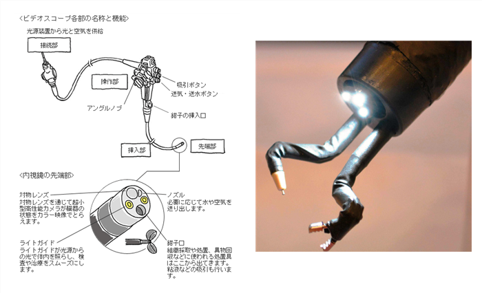 内視鏡　抗がん剤用