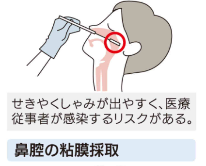 鼻　粘膜