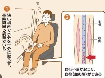 エコノミー
